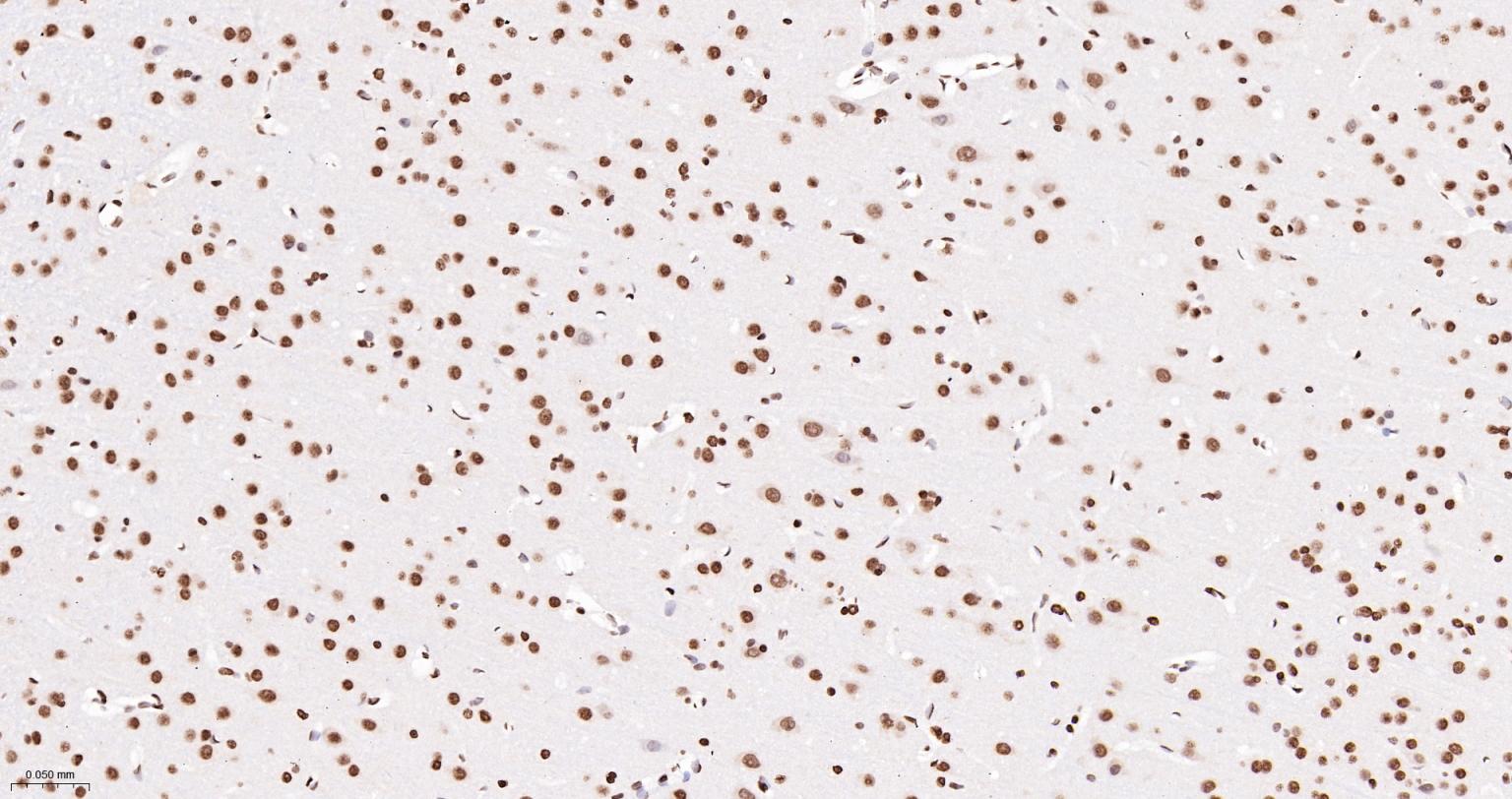组蛋白H3重组兔单抗-bsm-60350R