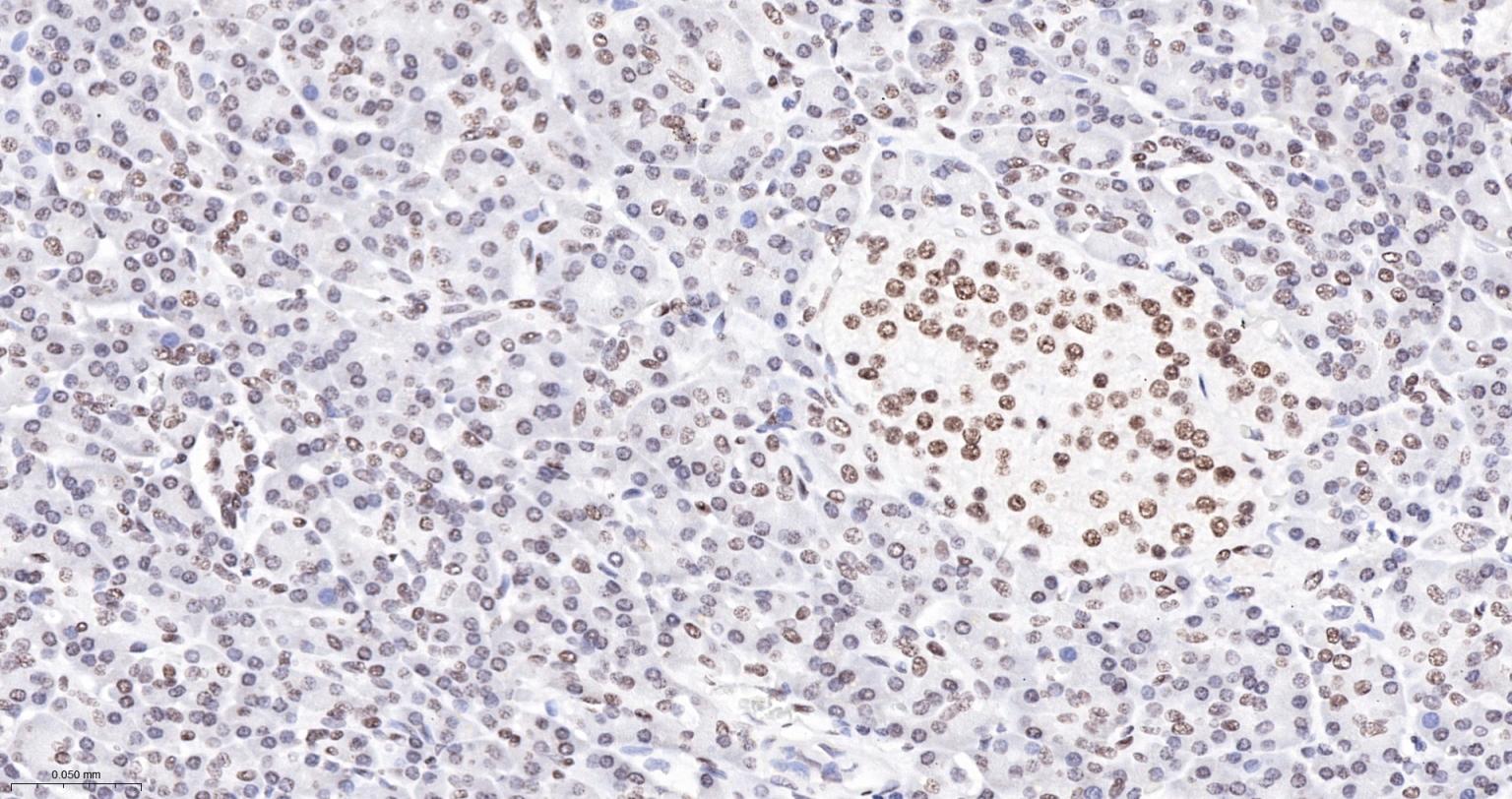 组蛋白H3重组兔单抗-bsm-60350R