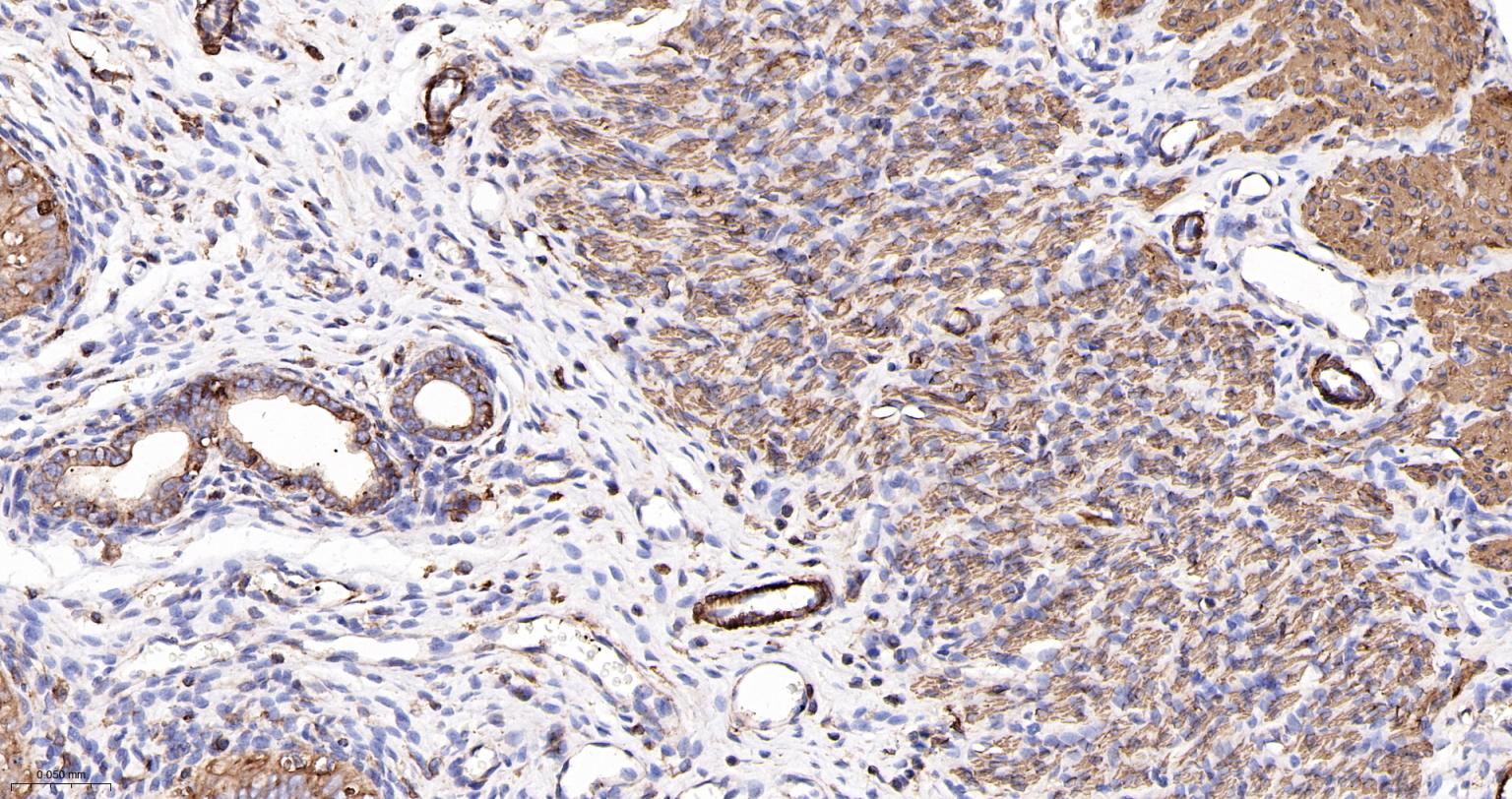 α-SMA重组兔单抗-bsm-52396R