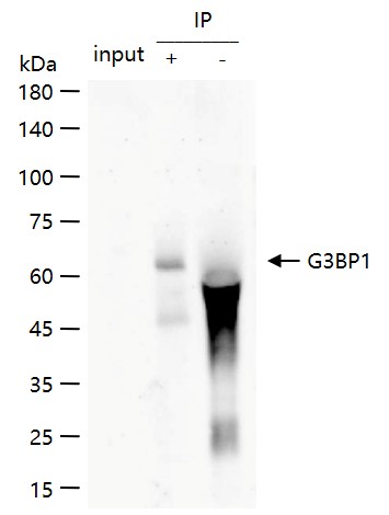 Ras GTP酶活化蛋白结合蛋白1重组兔单抗-bsm-62130R