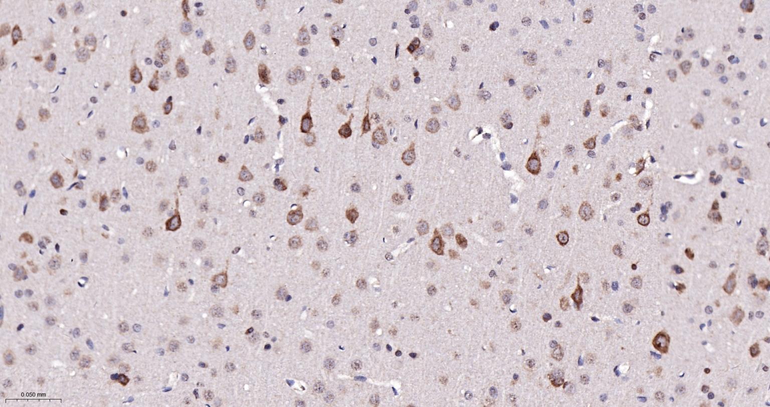 磷酸化真核启动因子2α抗体-bsm-52306R