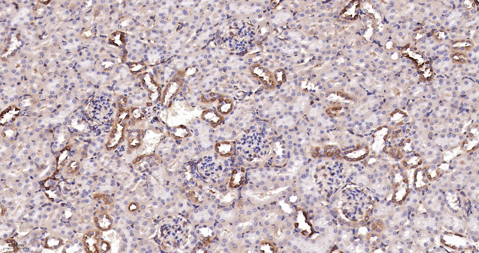 磷酸化真核启动因子2α抗体-bsm-52306R