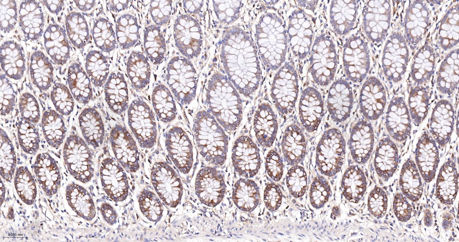 磷酸化真核启动因子2α抗体-bsm-52306R