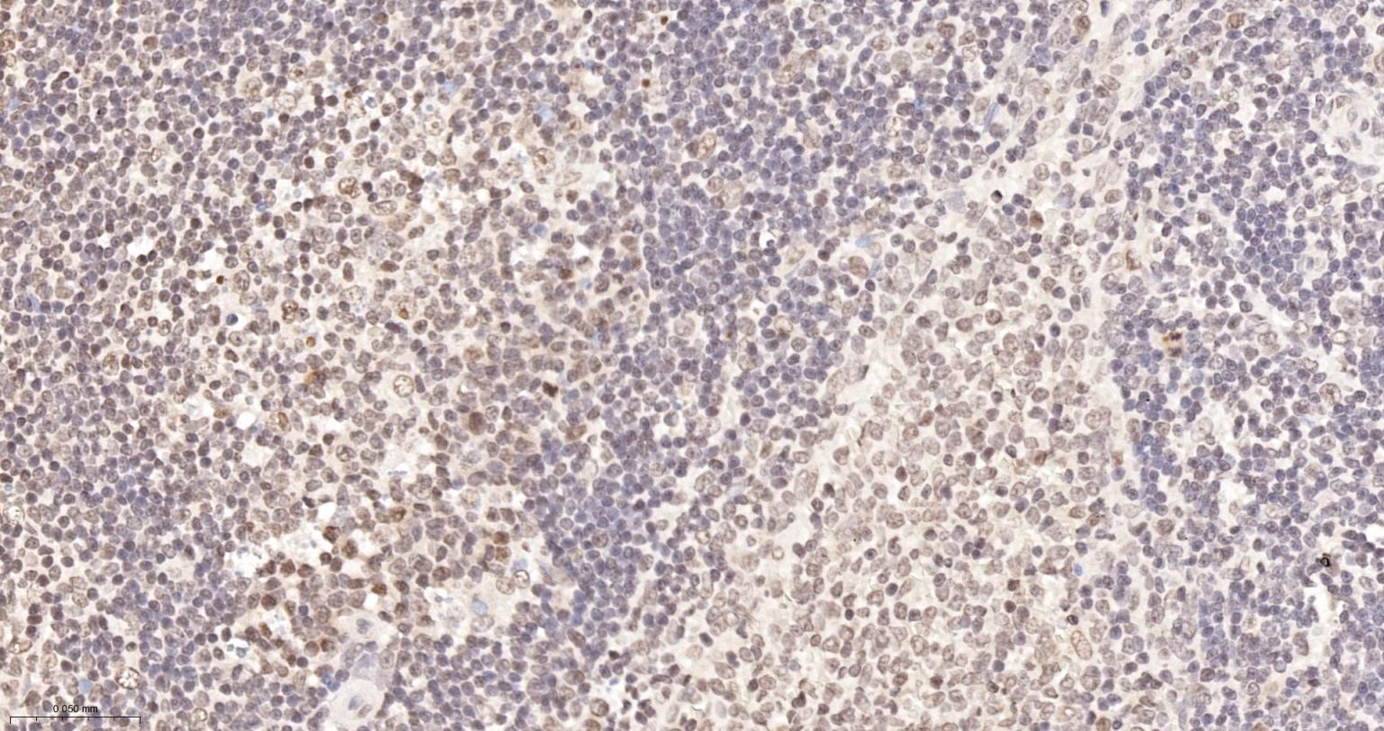 糖皮质激素受体抗体-bs-0252R