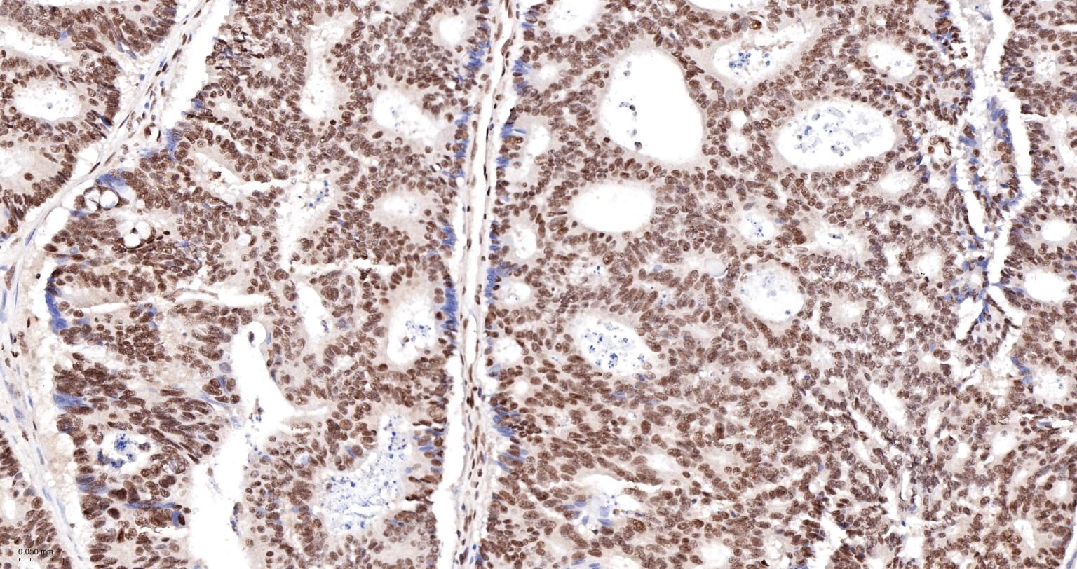 核转录调节因子YY1 （核内参）重组兔单抗-bsm-52349R