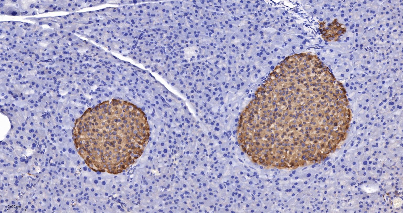 突触小泡蛋白P38重组兔单抗-bsm-52379R