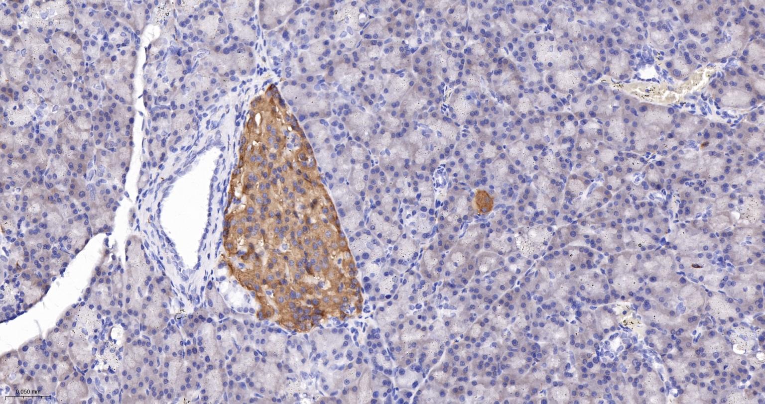 突触小泡蛋白P38重组兔单抗-bsm-52379R