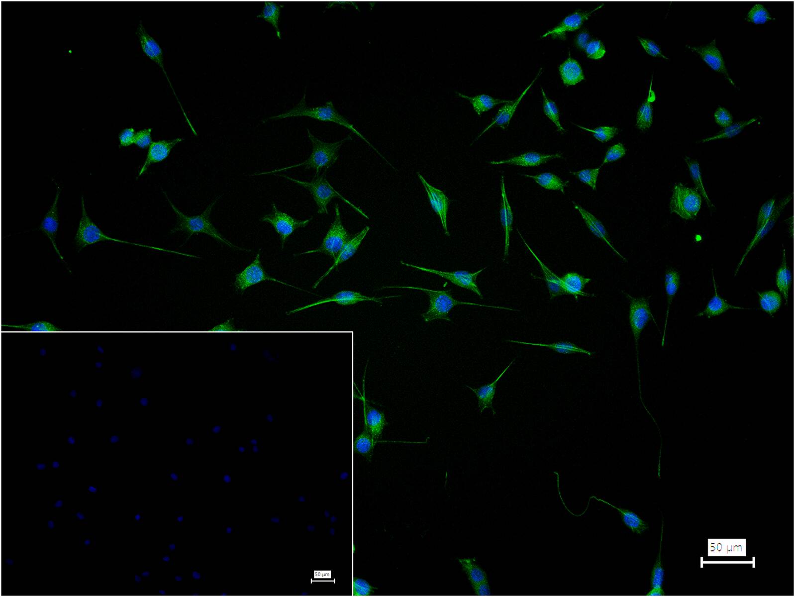 肌动蛋白α/α-SMA/α Actin单克隆抗体-bsm-33187M