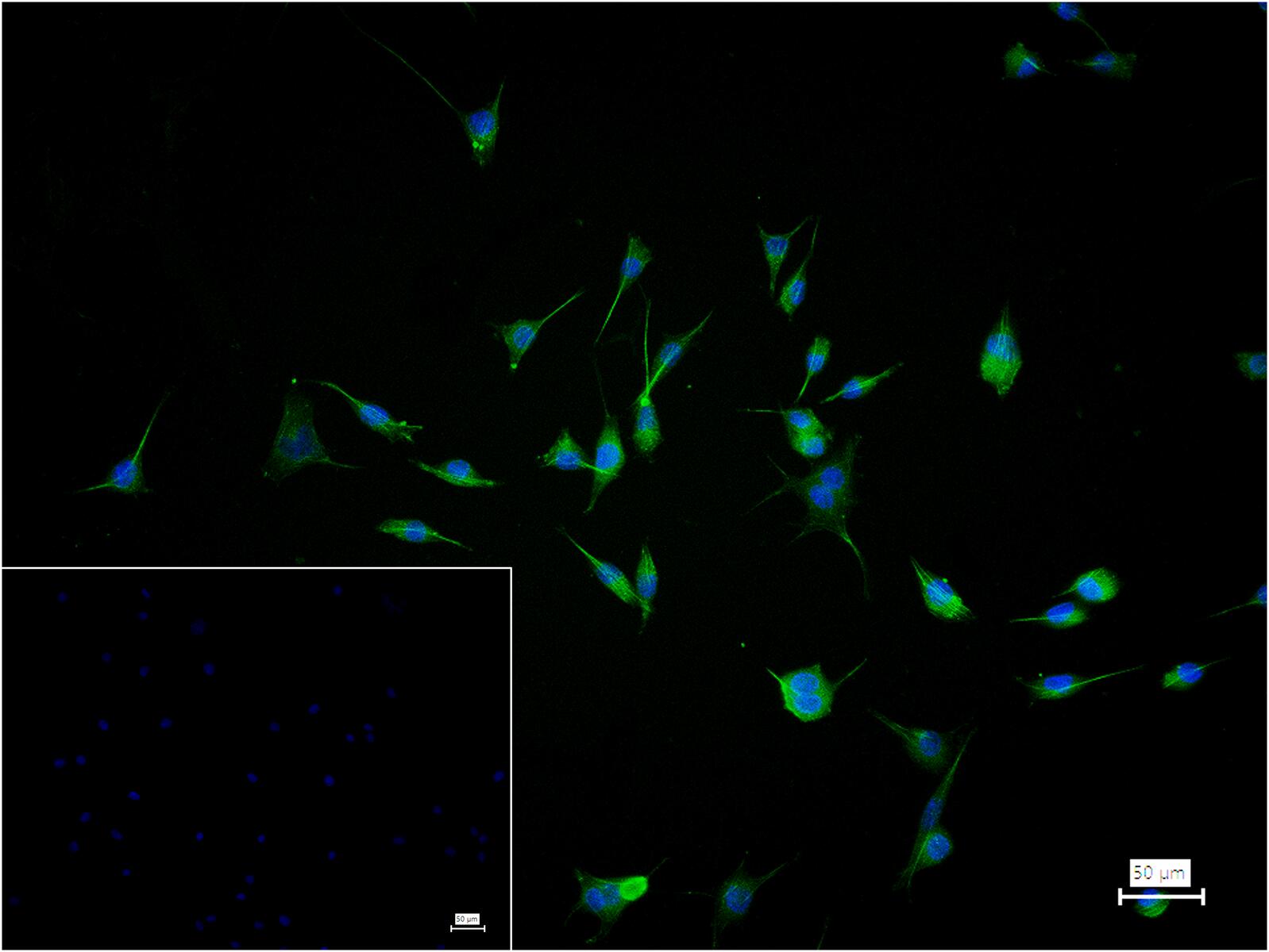 肌动蛋白α/α-SMA/α Actin单克隆抗体-bsm-33188M