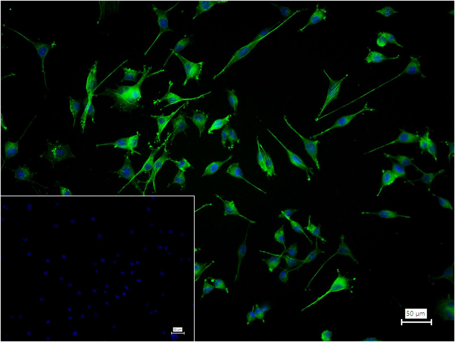 α-SMA重组兔单抗-bsm-52392R