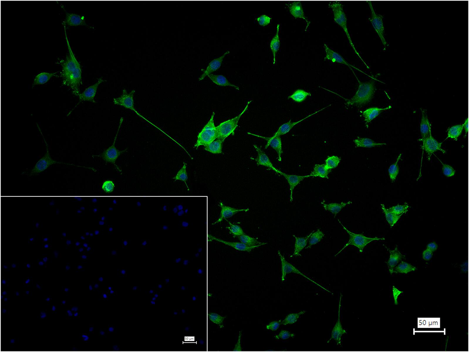 α-SMA重组兔单抗-bsm-52396R