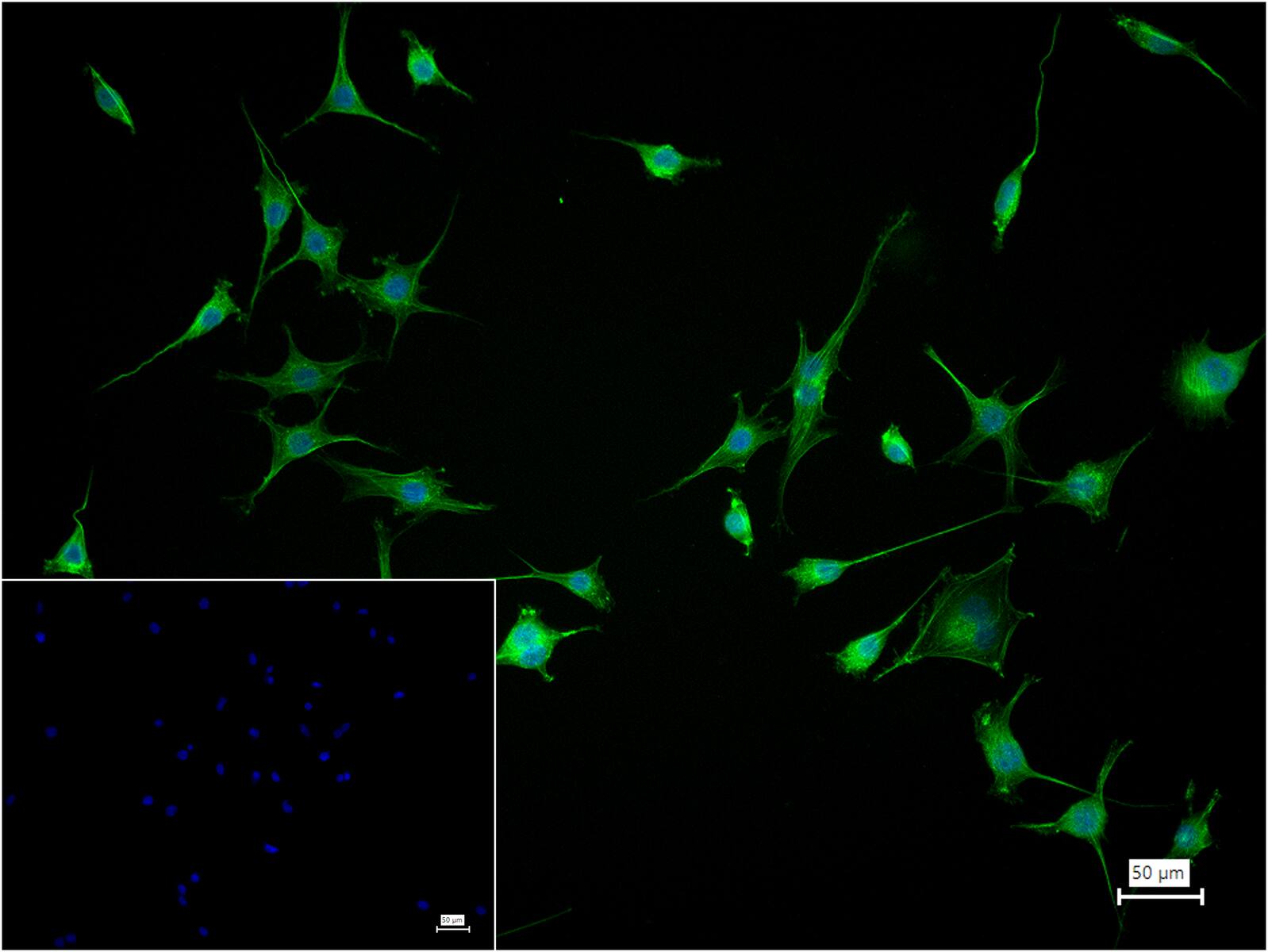 肌动蛋白α/α-SMA/α Actin重组兔单抗-bsm-33187R