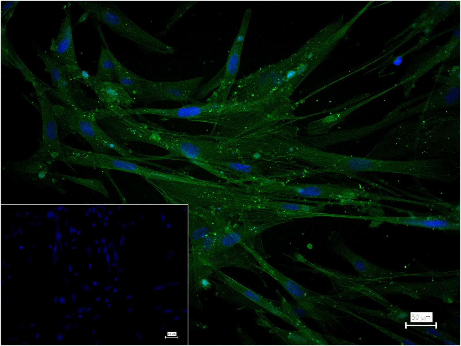 肌动蛋白α/α-SMA/α Actin抗体-bs-10196R