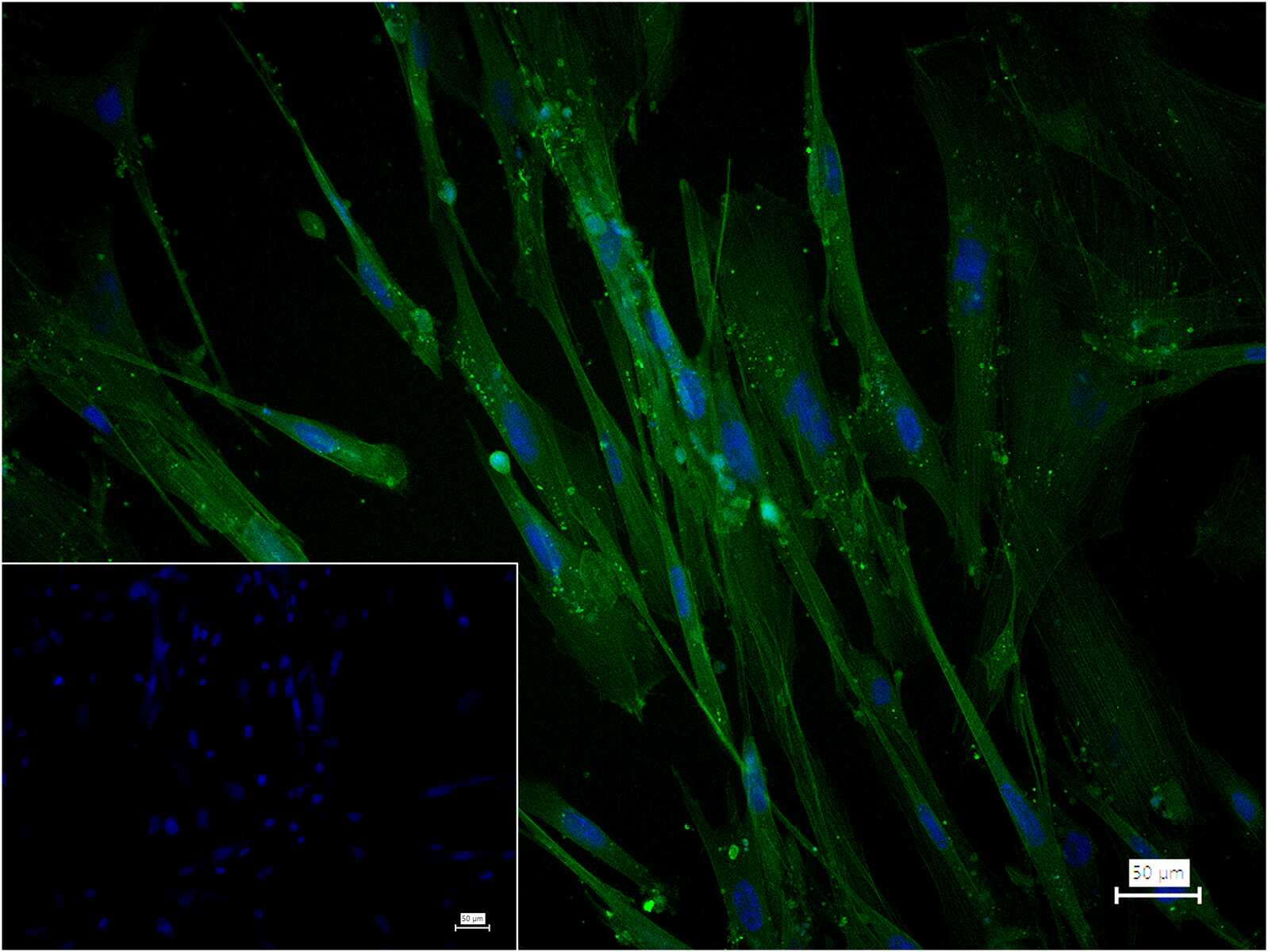 肌动蛋白α/α-SMA/α Actin抗体-bs-0189R