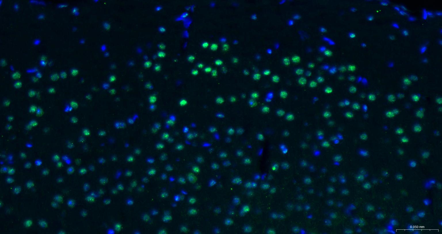 核转录调节因子YY1 （核内参）重组兔单抗-bsm-52349R